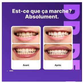 Bandes Blanchiment Dentaire (box1)